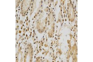 Immunohistochemistry of paraffin-embedded human stomach using HDAC6 antibody at dilution of 1:200 (x400 lens) (HDAC6 抗体  (AA 1-200))
