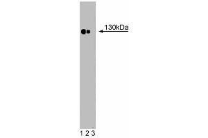 Western blot analysis of Phospholipase Cbeta4 on a rat pituitary lysate (left). (Phospholipase C beta 4 抗体  (AA 752-961))