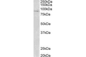 Western Blotting (WB) image for anti-SET Domain, Bifurcated 2 (SETDB2) (N-Term) antibody (ABIN2465045) (SETDB2 抗体  (N-Term))