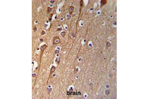 CI091 Antibody (C-term) IHC analysis in formalin fixed and paraffin embedded brain tissue followed by peroxidase conjugation of the secondary antibody and DAB staining. (C9ORF91 抗体  (C-Term))