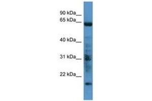 Image no. 1 for anti-G Protein-Coupled Receptor Kinase 7 (GRK7) (C-Term) antibody (ABIN6746684) (GRK7 抗体  (C-Term))