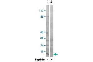 Western blot analysis of extracts from COS-7 cells, using MRPS21 polyclonal antibody . (MRPS21 抗体)