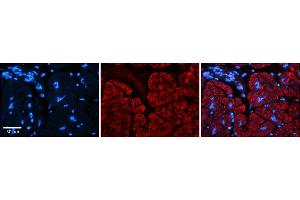 Rabbit Anti-AKAP7 Antibody    Formalin Fixed Paraffin Embedded Tissue: Human Adult heart  Observed Staining: Membrane, Cytoplasmic Primary Antibody Concentration: 1:600 Secondary Antibody: Donkey anti-Rabbit-Cy2/3 Secondary Antibody Concentration: 1:200 Magnification: 20X Exposure Time: 0. (AKAP7 抗体  (Middle Region))
