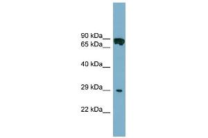 WB Suggested Anti-CYB5D1 Antibody Titration: 0. (CYB5D1 抗体  (Middle Region))