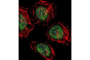 Fluorescent confocal image of Hela cell stained with CAF-1 Antibody (N-term) (ABIN655064 and ABIN2844694). (CNOT8 抗体  (N-Term))