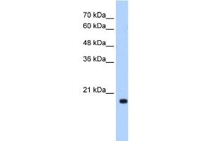 WB Suggested Anti-XTP3TPA Antibody Titration:  0. (DCTPP1 抗体  (N-Term))