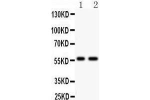 Anti- PIAS4 antibody, Western blotting All lanes: Anti PIAS4  at 0. (PIAS4 抗体  (C-Term))