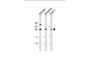 All lanes : Anti-TPD52 Antibody (N-Term) at 1:2000 dilution Lane 1: mouse brain lysate Lane 2: mouse kidney lysate Lane 3: THP-1 whole cell lysate Lysates/proteins at 20 μg per lane. (TPD52 抗体  (AA 11-44))