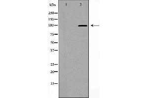 Western blot analysis of PSD95 expression in Brain (Rat) Tissue Lysate,The lane on the left is treated with the antigen-specific peptide. (DLG4 抗体  (C-Term))