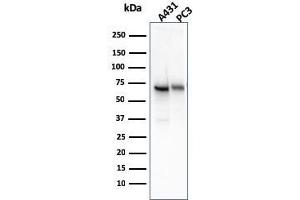 Western Blot Analysis of A431 and PC-3 cell lysate using CD73 Mouse Monoclonal Antibody (NT5E/2545). (CD73 抗体)