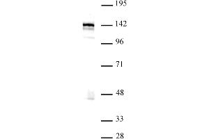 Western blot of BRD8 / SMAP2 antibody. (BRD8 抗体  (N-Term))