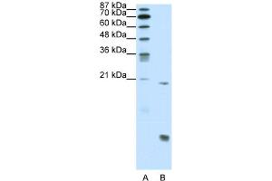 WB Suggested Anti-RUNX1 Antibody Titration:  0. (RUNX1 抗体  (N-Term))