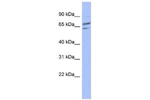WB Suggested Anti-PGM1 Antibody Titration: 0. (Phosphoglucomutase 1 抗体  (Middle Region))