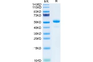 Lipocalin 2 (LCN2) (AA 21-200) protein (Fc Tag)