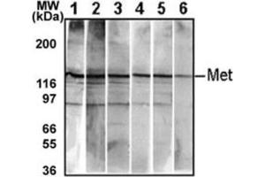 Western Blotting (WB) image for anti-Met Proto-Oncogene (MET) antibody (ABIN2995275) (c-MET 抗体)