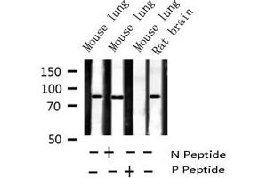 Western Blotting (WB) image for anti-Inhibitor of kappa Light Polypeptide Gene Enhancer in B-Cells, Kinase beta (IKBKB) (pTyr199) antibody (ABIN6256667)
