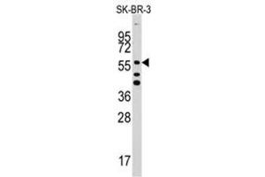 Image no. 1 for anti-Aldehyde Dehydrogenase 5 Family, Member A1 (ALDH5A1) (C-Term) antibody (ABIN356986) (ALDH5A1 抗体  (C-Term))