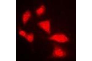 Immunofluorescent analysis of APOBEC3G staining in MCF7 cells. (APOBEC3G 抗体)