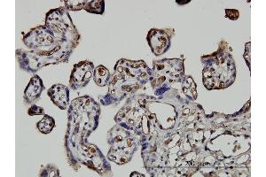 Immunostaining (ISt) image for anti-Neural Precursor Cell Expressed, Developmentally Down-Regulated 1 (NEDD1) (AA 561-660) antibody (ABIN566771)