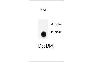 Dot blot analysis of anti-Phospho-GIT1-p Antibody (ABIN389936 and ABIN2839750) on nitrocellulose membrane. (GIT1 抗体  (pTyr554))