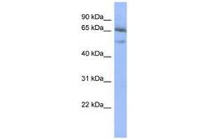 Image no. 1 for anti-Nuclear Factor of kappa Light Polypeptide Gene Enhancer in B-Cells Inhibitor, epsilon (NFKBIE) (AA 431-480) antibody (ABIN6742773) (NFKBIE 抗体  (AA 431-480))