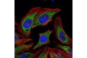 Immunofluorescence analysis of HELA cells using PDK1 mouse mAb (green). (PDPK1 抗体)
