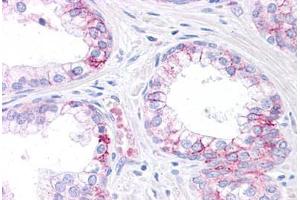 Human Prostate: Formalin-Fixed, Paraffin-Embedded (FFPE) (CEBPA 抗体  (AA 288-337))
