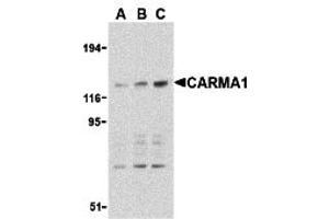 Western Blotting (WB) image for anti-Caspase Recruitment Domain Family, Member 11 (CARD11) (C-Term) antibody (ABIN1030313) (CARD11 抗体  (C-Term))