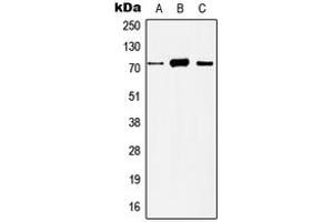 Western blot analysis of Histone Deacetylase 10 expression in HeLa (A), Jurkat (B), mouse liver (C), rat liver (D) whole cell lysates. (HDAC10 抗体  (N-Term))