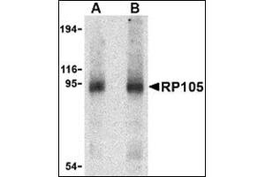 Western blot analysis of RP105 in human spleen tissue lysate with this product at (A) 0. (CD180 抗体  (Center))