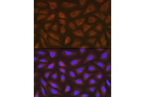 Immunofluorescence analysis of U-2 OS cells using eEF2 Rabbit mAb (ABIN7267025) at dilution of 1:100 (40x lens). (EEF2 抗体)