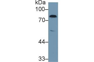 Western Blot; Sample: Rat Serum; Primary Ab: 1µg/ml Rabbit Anti-Rat F2 Antibody Second Ab: 0. (Prothrombin 抗体  (AA 44-200))