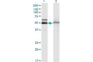 Western Blot analysis of HEXA expression in transfected 293T cell line by HEXA monoclonal antibody (M06A), clone 3D1. (Hexosaminidase A 抗体  (AA 1-529))