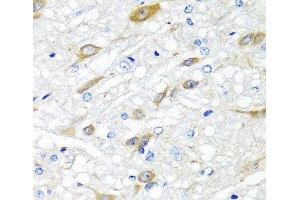 Immunohistochemistry of paraffin-embedded Rat brain using CPA6 Polyclonal Antibody at dilution of 1:100 (40x lens). (CPA6 抗体)