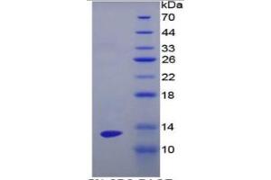 SDS-PAGE of Protein Standard from the Kit (Highly purified E. (ENO1 ELISA 试剂盒)