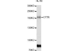 Western blot analysis of extracts of HL-60 cells, using CFTR antibody (ABIN5974674) at 1/1000 dilution. (CFTR 抗体)