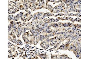 IHC analysis of CCNB1 using anti-CCNB1 antibody (ABIN7599335).