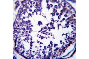 RAB5C antibody immunohistochemistry analysis in formalin fixed and paraffin embedded human testis tissue. (Rab5c 抗体  (AA 178-207))