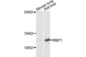 Western blot analysis of extracts of mouse lung and rat liver cells, using RBP1 antibody.