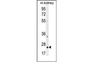 Western blot analysis of HOXB6 / HOX2B Antibody (Center) in mouse kidney tissue lysates (35ug/lane).