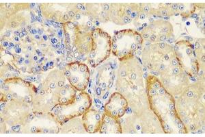 Immunohistochemistry of paraffin-embedded Rat kidney using MT1-MMP Polyclonal Antibody at dilution of 1:100 (40x lens). (MMP14 抗体)