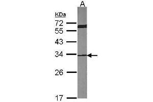Western Blotting (WB) image for anti-Cyclin-Dependent Kinase 4 (CDK4) antibody (ABIN2855529)