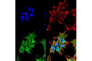 Immunocytochemistry/Immunofluorescence analysis using Mouse Anti-SUR1 Monoclonal Antibody, Clone S289-16 . (ABCC8 抗体  (AA 1548-1582) (Atto 594))