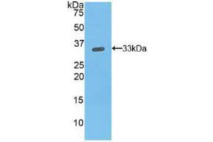 Western blot analysis of recombinant Mouse ITGb1. (ITGB1 抗体  (AA 454-714))