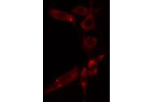ABIN6277280 staining  HuvEc cells by IF/ICC. (AIF 抗体  (C-Term))