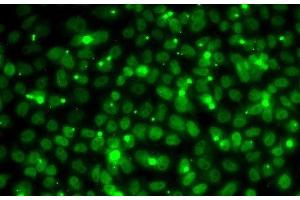 Immunofluorescence analysis of MCF7 cells using RPA3 Polyclonal Antibody (RPA3 抗体)