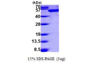SDS-PAGE (SDS) image for DEAD (Asp-Glu-Ala-Asp) Box Polypeptide 39 (DDX39) (AA 1-428) protein (His tag) (ABIN7279166)