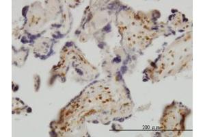 Image no. 1 for anti-Exosome Component 8 (EXOSC8) (AA 1-277) antibody (ABIN599183) (EXOSC8 抗体  (AA 1-277))