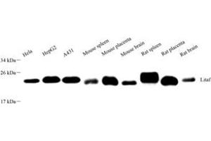 Western blot analysis of LITAF (ABIN7074508),at dilution of 1: 2000 (LITAF 抗体)