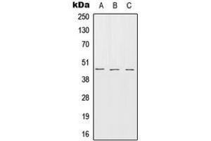 Western blot analysis of Serpin B7 expression in HEK293T (A), SP2/0 (B), rat brain (C) whole cell lysates.